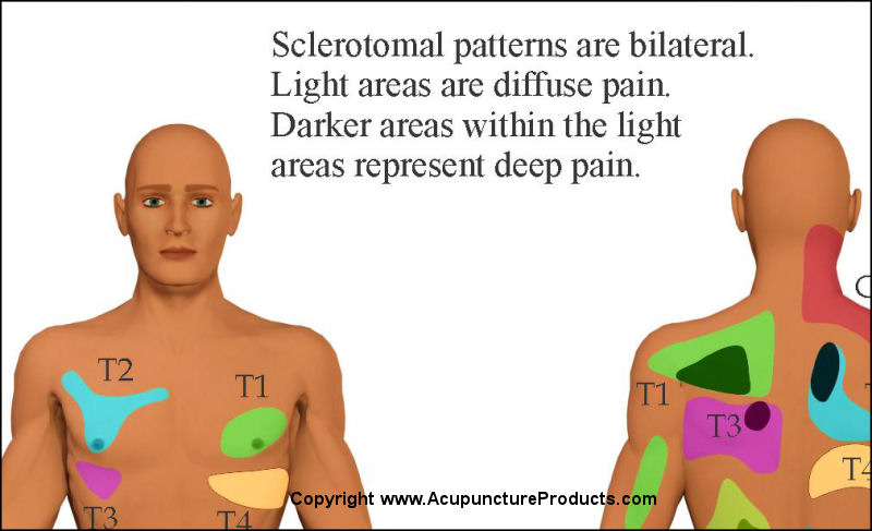 Sclerotome And Visceral Pain Chart